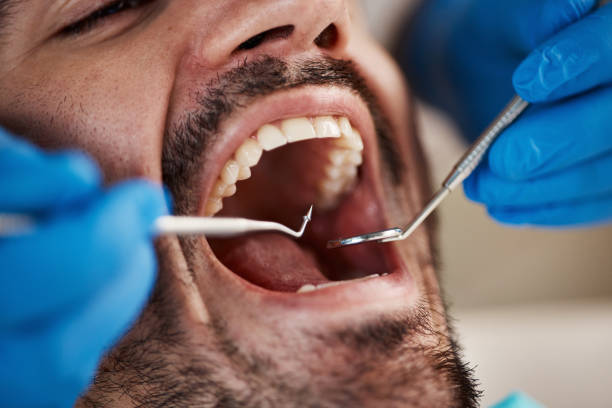 Best Dentist for Severe Toothache  in Pittsburg, TX